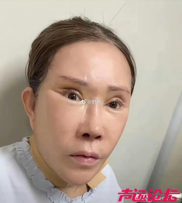 60岁整容成这样，是美是丑？网友议论纷纷-2.jpg
